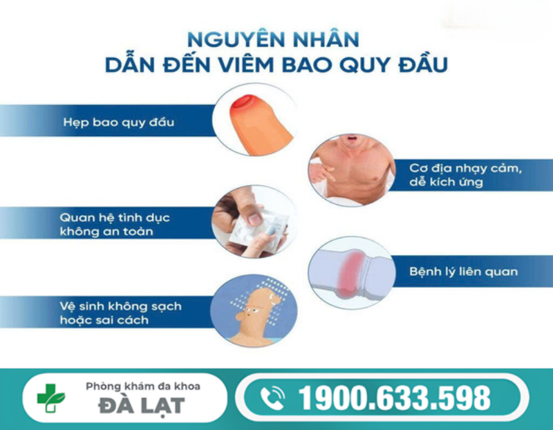 Hình ảnh minh họa